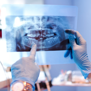 Dental with blue gloves looking at X-ray