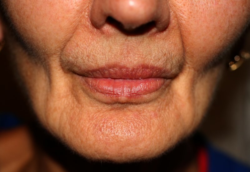 A closeup of a face with sunken cheeks